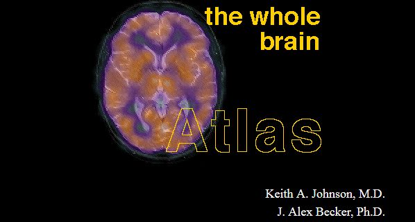 atlas mózgu